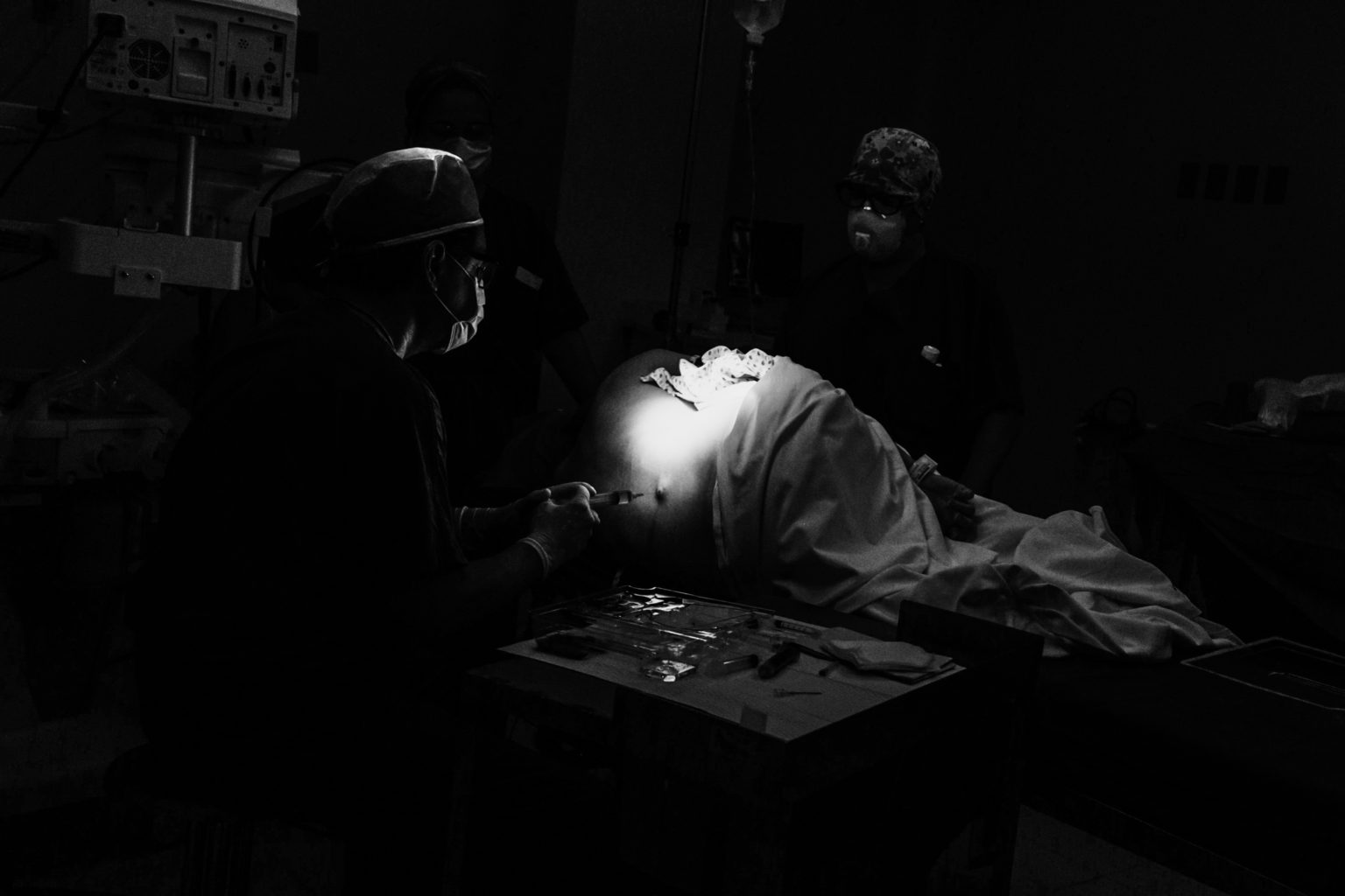 Anesthesiologist applies epidural anesthesia to a woman before delivering her baby in a Caesarean Section the 12 of May of 2020, in the City of Queretaro, Mexico. During times of Covid-19.